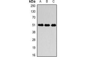 Western blot analysis of Fibrinogen gamma expression in SGC996 (A), mouse liver (B), mouse lung (C) whole cell lysates.