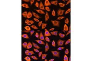 Immunofluorescence analysis of L929 cells using L Rabbit pAb (ABIN1680664, ABIN3018314, ABIN3018315 and ABIN6220434) at dilution of 1:100 (40x lens). (LASP1 Antikörper  (AA 130-205))