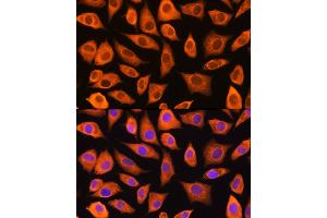 Immunofluorescence analysis of L929 cells using L Rabbit pAb (ABIN1680664, ABIN3018314, ABIN3018315 and ABIN6220434) at dilution of 1:100 (40x lens). (LASP1 Antikörper  (AA 130-205))