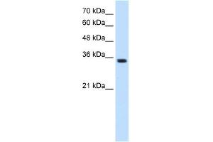 TRPM5 antibody used at 1.