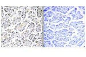 Immunohistochemistry (IHC) image for anti-ATP Synthase, H+ Transporting, Mitochondrial Fo Complex, Subunit C3 (Subunit 9) (ATP5G3) antibody (ABIN7183166)