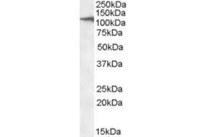 ABIN570963 (2µg/ml) staining of Human Liver lysate (35µg protein in RIPA buffer). (CLEC16A Antikörper  (AA 1040-53))