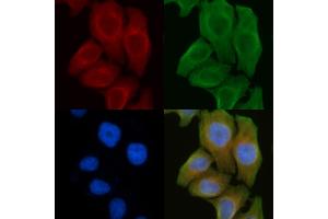 ABIN6261670 and ABIN6272297 staining Hela cells by IF/ICC.