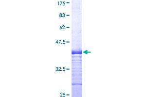 SLC11A2 Protein (AA 1-65) (GST tag)