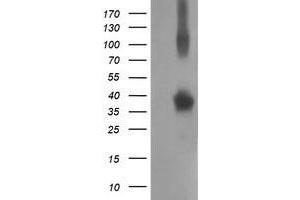 Western Blotting (WB) image for anti-Nonhomologous End-Joining Factor 1 (NHEJ1) antibody (ABIN1499733) (NHEJ1 Antikörper)