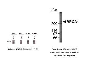 Image no. 3 for anti-Breast Cancer 1 (BRCA1) (AA 1314-1600), (AA 1314-1864) antibody (ABIN363286) (BRCA1 Antikörper  (AA 1314-1600, AA 1314-1864))