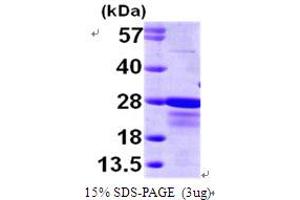 SDS-PAGE (SDS) image for Core-Binding Factor, beta Subunit (CBFB) (AA 1-182) protein (His tag) (ABIN7279124)