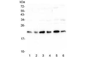 Western blot testing of human 1) HeLa, 2) placenta, 3) HepG2, 4) MCF7, 5) mouse testis and 6) mouse brain lysate with RKIP antibody at 0. (PEBP1 Antikörper)