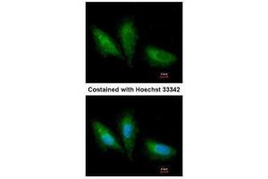 ICC/IF Image Immunofluorescence analysis of paraformaldehyde-fixed A549, using PRKCSH, antibody at 1:200 dilution. (PRKCSH Antikörper)