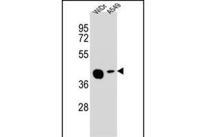 AC1L2 Antibody (N-term) (ABIN654847 and ABIN2844513) western blot analysis in WiDr,A549 cell line lysates (35 μg/lane). (AMAC1L2 Antikörper  (N-Term))