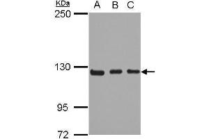 WB Image Sample (30 ug of whole cell lysate) A: 293T B: A431 C: HeLa 5% SDS PAGE antibody diluted at 1:1000