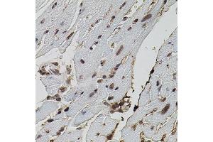 Immunohistochemistry of paraffin-embedded mouse heart using EIF4G2 antibody (ABIN5971499) (40x lens). (EIF4G2 Antikörper)