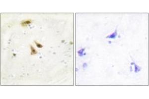 Immunohistochemistry analysis of paraffin-embedded human brain tissue, using UBF1 Antibody. (UBTF Antikörper  (AA 501-550))