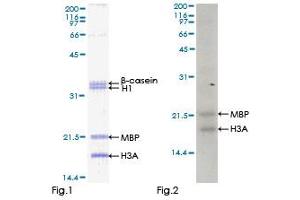 Kinase Activity Assay (KAA) image for Mitogen-Activated Protein Kinase Kinase Kinase MLT (ZAK) (AA 1-455) protein (GST tag) (ABIN1325564) (ZAK Protein (AA 1-455) (GST tag))