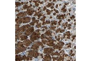 Immunohistochemical staining of human stomach with SLC2A13 polyclonal antibody  shows strong cytoplasmic positivity in glandular cells at 1:20-1:50 dilution.