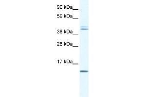 WB Suggested Anti-TSFM Antibody Titration:  0. (TSFM Antikörper  (N-Term))
