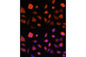 Immunofluorescence analysis of L929 cells using eIF2B epsilon (eIF2B epsilon (EIF2B5)) Rabbit pAb (ABIN6130359, ABIN6140041, ABIN6140042 and ABIN6214448) at dilution of 1:100.