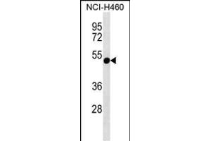 RTDR1 Antibody (N-term) (ABIN657164 and ABIN2846298) western blot analysis in NCI- cell line lysates (35 μg/lane). (RTDR1 Antikörper  (N-Term))