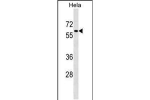 Western blot analysis in Hela cell line lysates (35ug/lane). (PAF1/PD2 Antikörper  (C-Term))