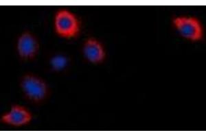 Immunofluorescent analysis of Cytochrome P450 2W1 staining in Hela cells. (CYP2W1 Antikörper)