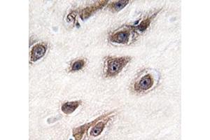 Immunohistochemistry (IHC) image for anti-Growth Factor Receptor-Bound Protein 2 (GRB2) (AA 89-118) antibody (ABIN3031114)
