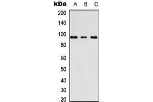 Western blot analysis of AKAP3 expression in Raw264. (AKAP3 Antikörper  (Center))