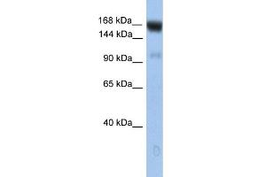 WB Suggested Anti-UBE4B Antibody Titration: 0. (UBE4B Antikörper  (N-Term))