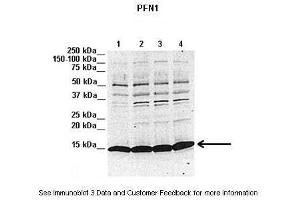 Lanes:   1. (PFN1 Antikörper  (N-Term))