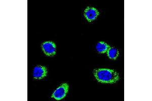 Confocal immunofluorescent analysis of B-RAF Antibody  f with Hela cell followed by Alexa Fluor 488-conjugated goat anti-rabbit lgG (green). (SNRPE Antikörper  (AA 424-453))