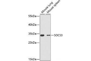 Western blot analysis of extracts of various cell lines using SOCS3 Polyclonal Antibody at dilution of 1:3000. (SOCS3 Antikörper)