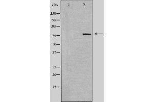 Western blot analysis of extracts from 293 cells using TACC3 antibody. (TACC3 Antikörper  (C-Term))