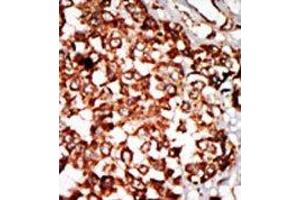 Image no. 1 for anti-Nuclear Receptor Binding Protein 1 (NRBP1) (N-Term) antibody (ABIN360550) (NRBP1 Antikörper  (N-Term))