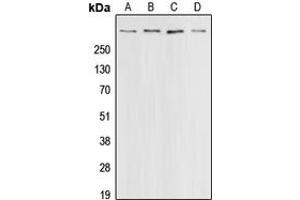 Western blot analysis of CBP expression in HeLa (A), A431 (B), HT29 (C), A549 (D) whole cell lysates. (CBP Antikörper  (C-Term))