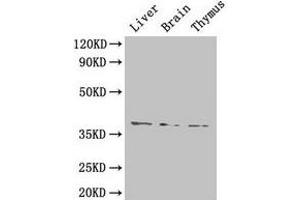 Western Blot Positive WB detected in: Mouse liver tissue, Mouse brain tissue, Mouse thymus tissue All lanes: HAVCR1 antibody at 4 μg/mL Secondary Goat polyclonal to rabbit IgG at 1/50000 dilution Predicted band size: 39 kDa Observed band size: 39 kDa (HAVCR1 Antikörper  (AA 21-290))