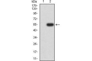 Western blot analysis using PGR mAb against HEK293-6e (1) and PGR (AA: 166-411)-hIgGFc transfected HEK293-6e (2) cell lysate. (Progesterone Receptor Antikörper  (AA 166-411))