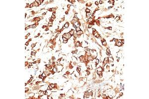 Immunohistochemistry (IHC) image for anti-Keratin 13 (KRT13) (AA 269-458) antibody (ABIN7268090)