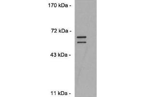 Diluted 1:10,000 on C2C12 cells transfected with pCS2-DUX4. (DUX4 Antikörper  (C-Term))