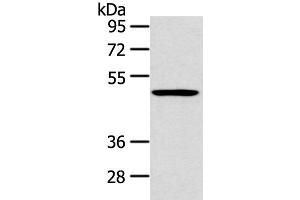 Western blot analysis of 231 cell using HTRA1 Polyclonal Antibody at dilution of 1:500 (HTRA1 Antikörper)