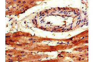 Immunohistochemistry of paraffin-embedded human heart tissue using ABIN7172377 at dilution of 1:100 (TRAPPC9 Antikörper  (AA 780-1030))