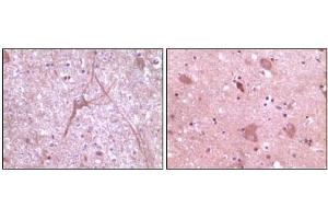 Immunohistochemical analysis of paraffin-embedded human cerebrum tissue (left) and myelencephalon tissue (right), showing cytoplasmic localization using Dynamin2 mouse mAb with DAB staining. (DNM2 Antikörper)
