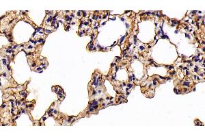 Immunohistochemistry (IHC) image for anti-Keratin 7 (KRT7) (AA 91-394) antibody (ABIN7432025)