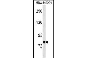 Western blot analysis in MDA-MB231 cell line lysates (35ug/lane). (MFI2 Antikörper  (C-Term))