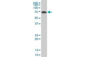 IL31RA polyclonal antibody (A01). (IL31RA Antikörper  (AA 21-120))