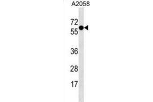 Western Blotting (WB) image for anti-Synaptotagmin IV (SYT4) antibody (ABIN3000889) (SYT4 Antikörper)