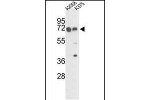 Western blot analysis of FKBP10 Antibody (C-term) (ABIN391573 and ABIN2841510) in  and  cell line lysates (35 μg/lane).