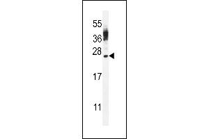 CT45A Antibody (Center) (ABIN656065 and ABIN2850490) western blot analysis in WiDr cell line lysates (35 μg/lane). (CT45A4/CT45A3/CT45A2/CT45A1/CT45A6 (AA 106-135) Antikörper)