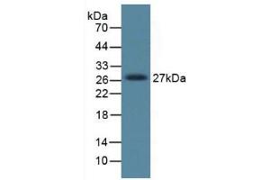 Figure. (DKK1 Antikörper  (AA 33-266))