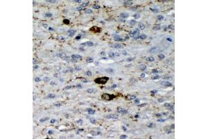 IHC analysis of GAD65/GAD2 using anti-GAD65/GAD2 antibody (ABIN7603170). (GAD65 Antikörper  (N-Term))