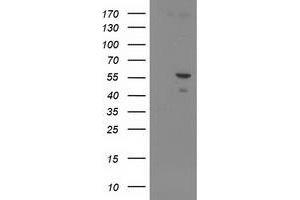 Image no. 1 for anti-Paraneoplastic Antigen MA3 (PNMA3) antibody (ABIN1500304) (PNMA3 Antikörper)
