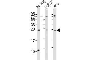 All lanes : Anti-SOST Antibody (N-term) at 1:2000 dilution Lane 1: mouse lung lysates Lane 2: human liver lysates Lane 3: Hela whole cell lysates Lysates/proteins at 20 μg per lane. (Sclerostin Antikörper  (N-Term))